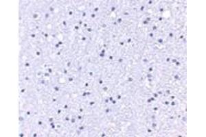 Immunohistochemistry (IHC) image for anti-Anaphase Promoting Complex Subunit 1 (ANAPC1) (C-Term) antibody (ABIN1030243) (APC1 抗体  (C-Term))