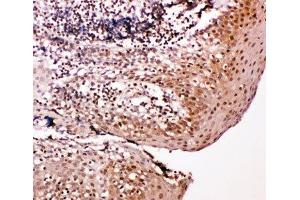 IHC-P: Caspase-14 antibody testing of human tonsil tissue (CASP14 抗体  (AA 223-242))