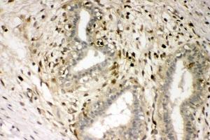 IHC analysis of S100A4 using anti-S100A4 antibody (ABIN7600462). (s100a4 抗体  (AA 2-101))