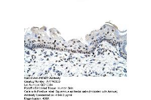 Rabbit Anti-RBM28 Antibody  Paraffin Embedded Tissue: Human Skin Cellular Data: Squamous epithelial cells Antibody Concentration: 4. (RBM28 抗体  (C-Term))