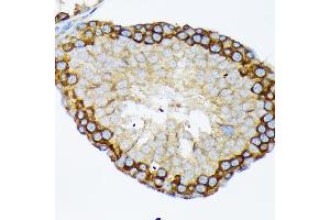 Immunohistochemistry of paraffin-embedded rat testis using USP9X Rabbit mAb (ABIN7271169) at dilution of 1:100 (40x lens). (USP9X 抗体)
