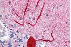 Human Brain, cerebellum: Formalin-Fixed, Paraffin-Embedded (FFPE) (ENPEP 抗体  (AA 689-932))