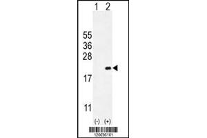 Western blot analysis of CDKN2C using rabbit polyclonal CDKN2C Antibody using 293 cell lysates (2 ug/lane) either nontransfected (Lane 1) or transiently transfected (Lane 2) with the CDKN2C gene. (CDKN2C 抗体  (C-Term))