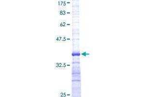 DLL1 Protein (AA 18-109) (GST tag)