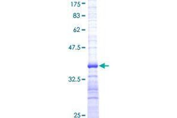 DLL1 Protein (AA 18-109) (GST tag)