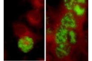 Immunofluorescence (IF) image for anti-Herpes Simplex Virus ICP5 (HSV ICP5) antibody (ABIN265570) (HSV ICP5 抗体)