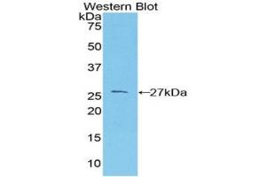 Detection of Recombinant PRNP, Mouse using Polyclonal Antibody to Prion Protein (PRNP) (PRNP 抗体  (AA 23-230))