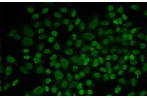 Immunofluorescence analysis of MCF-7 cells using RAD54L2 Polyclonal Antibody