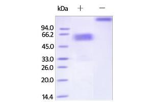 SDS-PAGE (SDS) image for Hepatitis A Virus Cellular Receptor 2 (TIM 3) (AA 22-200) (Active) protein (Fc Tag) (ABIN2181819)