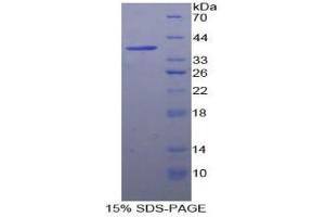 SDS-PAGE analysis of Human Fatty Acid Synthase Protein. (Fatty Acid Synthase Protein (FASN))