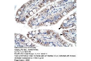 Human Intestine (CCL18 抗体  (Middle Region))