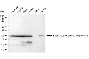 Western blotting analysis using B cell receptor associated protein 31 antibody (ABIN7797723). (Recombinant BCAP31 抗体)