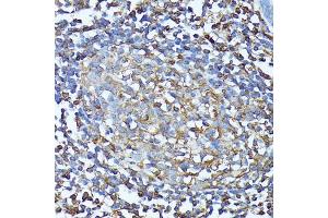 Immunohistochemistry (IHC) image for anti-Chemokine (C-X-C Motif) Receptor 1 (CXCR1) (AA 250-350) antibody (ABIN7266317)