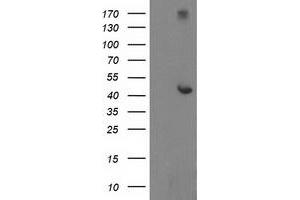 Western Blotting (WB) image for anti-Adaptor-Related Protein Complex 2, mu 1 Subunit (AP2M1) (AA 97-383) antibody (ABIN1491719) (AP2M1 抗体  (AA 97-383))