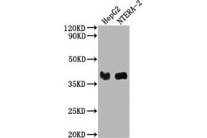 Western Blot Positive WB detected in: HepG2 whole cell lysate, NTERA-2 whole cell lysate All lanes: LCMT1 antibody at 1:2000 Secondary Goat polyclonal to rabbit IgG at 1/50000 dilution Predicted band size: 39, 42, 33 kDa Observed band size: 39 kDa (LCMT1 抗体  (AA 157-357))