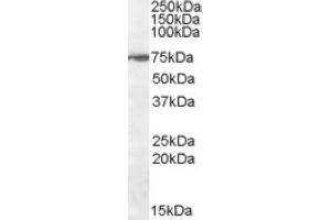 Image no. 1 for anti-Zinc Finger Protein 803 (ZNF803) (Internal Region) antibody (ABIN375091)