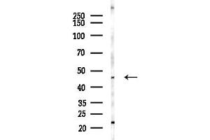 anti-Serpin Family A Member 7 (SERPINA7) antibody