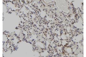 ABIN6272516 at 1/100 staining Rat lung tissue by IHC-P. (MAGED2 抗体  (N-Term))