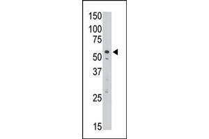 The anti-DSiglec C-term  Pab (ABIN388430 and ABIN2837866) is used in Western blot to detect DSiglec in Jurkat cell lysate. (SIGLEC7 抗体  (C-Term))