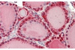 Immunohistochemistry (IHC) image for anti-Glutathione S-Transferase pi 1 (GSTP1) (AA 1-210) antibody (ABIN7433147)