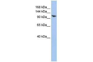 WB Suggested Anti-RNF20 Antibody Titration:  0. (RNF20 抗体  (N-Term))