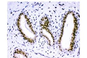 IHC analysis of KDM5B using anti-KDM5B antibody (ABIN4886648).