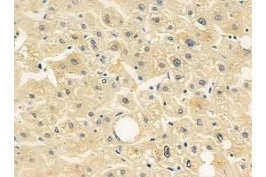 ABIN6257656 and ABIN6273368 at 1/100 staining human normal liver tissue by IHC-P.