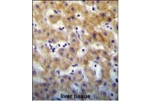 KT Antibody (C-term) (ABIN655129 and ABIN2844756) immunohistochemistry analysis in formalin fixed and paraffin embedded human liver tissue followed by peroxidase conjugation of the secondary antibody and DAB staining. (KRTCAP2 抗体  (C-Term))