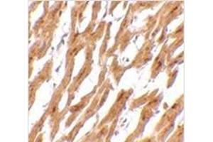 Immunohistochemistry of ASAH1 in human heart tissue with ASAH1 antibody at 2. (ASAH1 抗体  (C-Term))