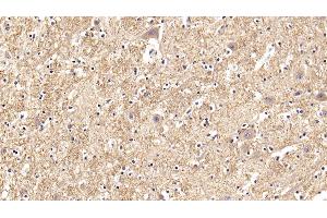 Detection of GLb in Human Spinal cord Tissue using Polyclonal Antibody to Galactosidase Beta (GLb) (GLB1 抗体  (AA 68-219))