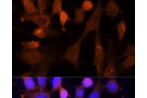 Immunofluorescence analysis of NIH-3T3 cells using VPS26A Polyclonal Antibody at dilution of 1:100 (40x lens). (VPS26A 抗体)
