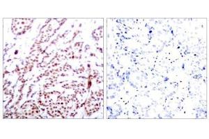 Image no. 1 for anti-Activating Transcription Factor 2 (ATF2) (pThr55), (pThr73) antibody (ABIN196668) (ATF2 抗体  (pThr55, pThr73))
