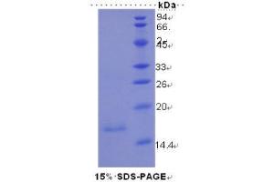 SDS-PAGE (SDS) image for Mucin 5 Subtype B (MUC5B) (AA 5366-5444) protein (His tag) (ABIN1080323)