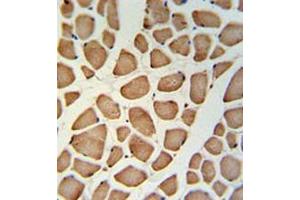 Immunohistochemistry analysis in skeletal muscle (Formalin-fixed, Paraffin-embedded) using TECR / GPSN2  Antibody (C-term), followed by peroxidase conjugation of the secondary antibody and DAB staining. (TECR 抗体  (C-Term))
