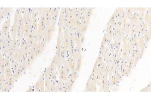 Detection of PDL1 in Human Cardiac Muscle Tissue using Monoclonal Antibody to Programmed Cell Death Protein 1 Ligand 1 (PDL1) (PD-L1 抗体  (AA 24-234))