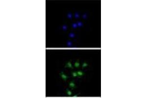 Immunofluorescence (IF) image for anti-Fanconi Anemia, Complementation Group C (FANCC) (AA 529-558), (C-Term) antibody (ABIN952264)