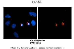 Sample Type: Human brain stem cells Primary Antibody Dilution: 1:500Secondary Antibody: Goat anti-rabbit Alexa-Fluor 594 Secondary Antibody Dilution: 1:0000Color/Signal Descriptions: PDIA3: Red DAPI: Blue  Gene Name: PDIA3 Submitted by: Dr.
