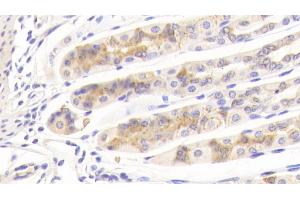 Detection of BGN in Mouse Stomach Tissue using Polyclonal Antibody to Biglycan (BGN)