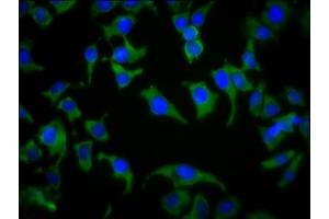 Immunofluorescence staining of A549 cells with ABIN7169627 at 1:133, counter-stained with DAPI. (SPPL2B 抗体  (AA 492-592))