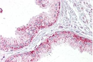 Immunohistochemistry with Prostate tissue at an antibody concentration of 5µg/ml using anti-AURKA antibody (ARP30876_P050) (Aurora A 抗体  (C-Term))