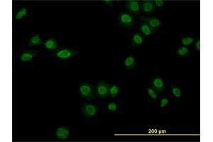 Immunofluorescence of monoclonal antibody to NR1D1 on HeLa cell. (NR1D1 抗体  (AA 1-614))