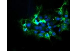 Anti-DPH2 mouse monoclonal antibody (ABIN2455861) immunofluorescent staining of COS7 cells transiently transfected by pCMV6-ENTRY DPH2 (RC201382). (DPH2 抗体)
