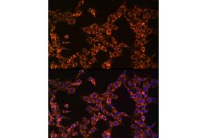Immunofluorescence analysis of PC-12 cells using UB Rabbit mAb (ABIN7271128) at dilution of 1:50 (40x lens).