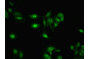 Immunofluorescent analysis of Hela cells using ABIN7168309 at dilution of 1:100 and Alexa Fluor 488-congugated AffiniPure Goat Anti-Rabbit IgG(H+L) (RBMY1A1 抗体  (AA 1-459))