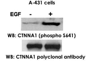 Western blot analysis of extract from A-431 cells, untreated ortreated with EGF (200ng/ml, 30min), using CTNNA1 polyclonal antibody  and CTNNA1 (phospho S641) polyclonal antibody . (CTNNA1 抗体  (pSer641))