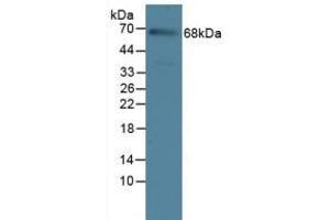 Detection of IL23R in Rat Serum Tissue using Polyclonal Antibody to Interleukin 23 Receptor (IL23R) (IL23R 抗体  (AA 25-355))