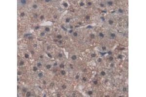 IHC-P analysis of Human Tissue, with DAB staining.
