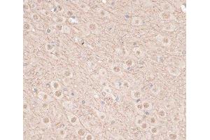 Immunohistochemistry of paraffin-embedded Mouse brain using VEGF Receptor 2 Polyclonal Antibody at dilution of 1:100 (40x lens). (VEGFR2/CD309 抗体)