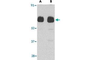 Western blot analysis of UNC93B1 in human heart tissue lysate with UNC93B1 polyclonal antibody  at (A) 0. (UNC93B1 抗体  (N-Term))