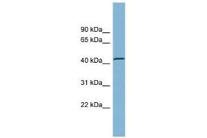 TBC1D13 antibody used at 1 ug/ml to detect target protein.
